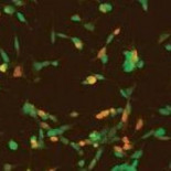 ¿Por qué los chimpancés no pueden hablar?