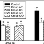 Una borrachera al inicio del embarazo puede ser fatal
