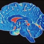 Descubren genes causantes de cáncer cerebral