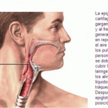 Atragantamiento y maniobra de Heimlich