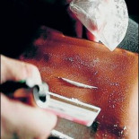 Una bacteria puede frenar la adicción a la cocaína