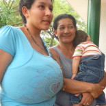 Gigantomastia: 'No soporto el peso de mis tetas'