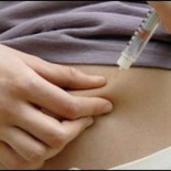 Exitoso páncreas artificial para diabetes