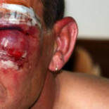 Militares británicos agreden a varias personas en Lanzarote