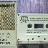 Grabar canciones en cintas de casete está matando la música