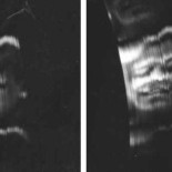 ¿La primera persona que apareció en televisión?