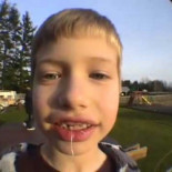 Cómo sacar un diente con un cohete