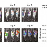 Médico español usa virus modificados genéticamente para transportar linfocitos contra el cáncer (ING)