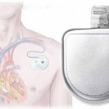 Los riesgos de usar software propietario en medicina