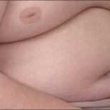 Ministra de Sanidad británica: a las personas con sobrepeso hay que llamarlas "gordos" y no "obesos" [ENG]