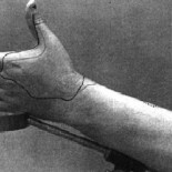 El neurólogo que se cortó los nervios