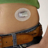 Creado un páncreas artificial que puede revolucionar el tratamiento de la diabetes