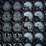 Neurocientífico experto en psicópatas se somete a un escáner cerebral y descubre que tiene el cerebro de un psicópata