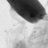 Consiguen grabar cómo beben las moscas