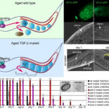 La “menopausia” en gusanos puede ayudar a estudiar la menopausia de las mujeres