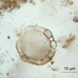 ¿…y sólo sobrevivirán las cucarachas y las ratas…?