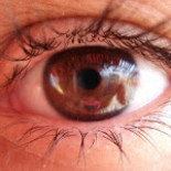 ¿A qué se deben los "tics" en el ojo?