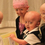 Detienen por primera vez el envejecimiento humano