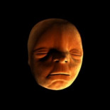 Así se forma el surco que hay entre la nariz y el labio superior