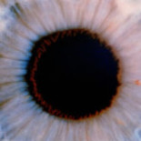 Tras 55 años ciego, cirujanos le restauran la vista