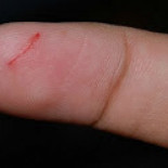 ¿Por qué nos duele tanto un corte con una hoja de papel?