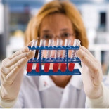 Científicos desarrollan un método para detectar el Alzheimer antes de mostrar síntomas [ENG]