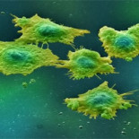 Científicos descubren cómo se propagan las células cancerígenas en el cuerpo