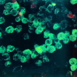 "Las amebas comecerebros" se cobran su tercera víctima este verano en EEUU (ING)