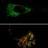 Una gallega monta una empresa para crear un anticancerígeno
