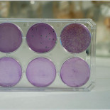 Los diez años de duro trabajo invertidos en el candidato de vacuna contra el VIH del CSIC