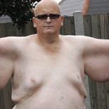 Pierde 258 kilos y ahora tiene que operarse para sacarse la piel sobrante