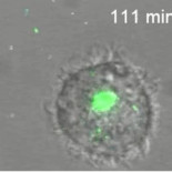 Grabadas por primera vez imágenes en vivo de cómo el VIH crea un 'caballo de Troya' para infectar