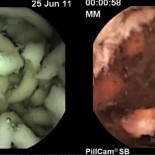De la boca al ano: fideos industriales frente a fideos caseros en su viaje por el tracto intestinal