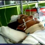 Un grupo neonazi graba esvásticas en el cuerpo de un homosexual chileno y lo golpea hasta dejarlo en coma