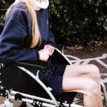 Impresionante recuperación de una joven anoréxica que se encontraba al borde de la muerte