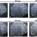 Las garrapatas sobreviven al vacío