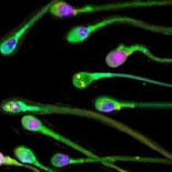 La popular vasectomía dejará de ser gratuita