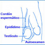 Como hacerse un autoexamen testicular