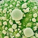 Hallan gen que detiene el cáncer de páncreas