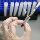 Evaluación, educación e intervención nutricional en Síndrome de Down