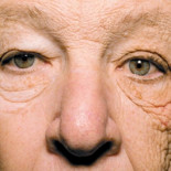 Cuando el sol te da sólo de un lado