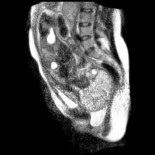 El primer parto grabado por dentro (con resonancia magnética)