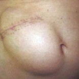 No te vas a creer lo que tiene esta ex reina de belleza en su abdomen [EN]