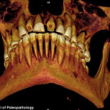 Encuentran una momia egipcia de 2.100 años de antigüedad con empastes en los dientes