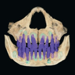 Los neandertales no tenían caries