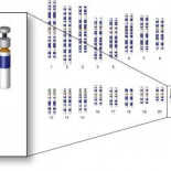 Suprimida la copia extra del cromosoma que produce el Síndrome de Down