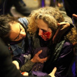 Reconstruyen un ojo a una mujer herida durante el 14-N, que perderá parte de la visión