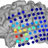 Anestesia y sueño: así se apaga y se reinicia la conciencia