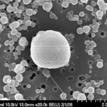 Encuentran una colonia de bacterias bajo 27 metros de hielo en la Antártida