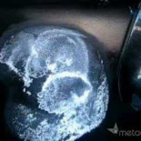 Cómo quitar un golpe del coche en menos de 3 minutos